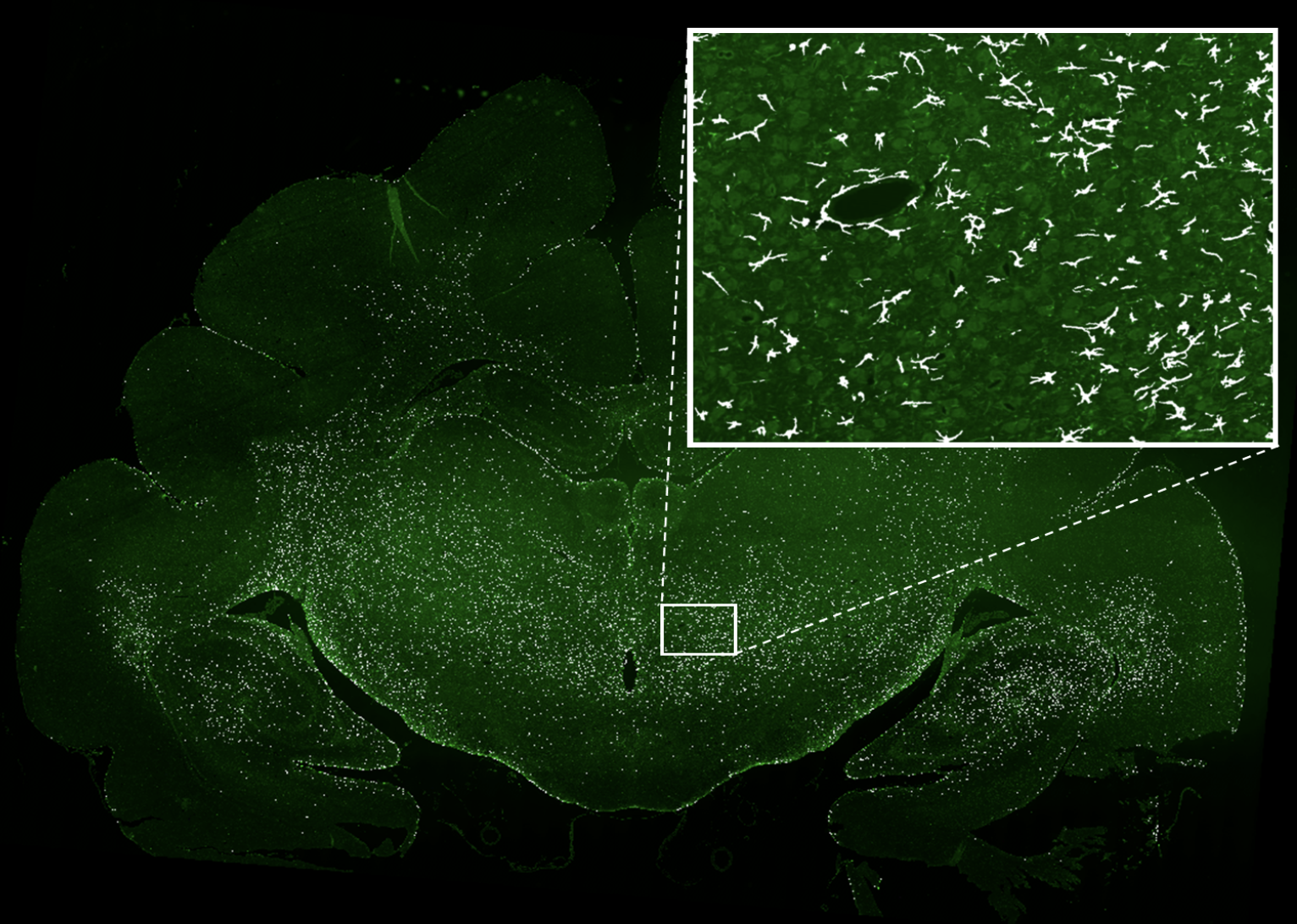 Comprehensive benchmarking of deep learning approaches for automated astrocyte segmentation in traumatic brain injury