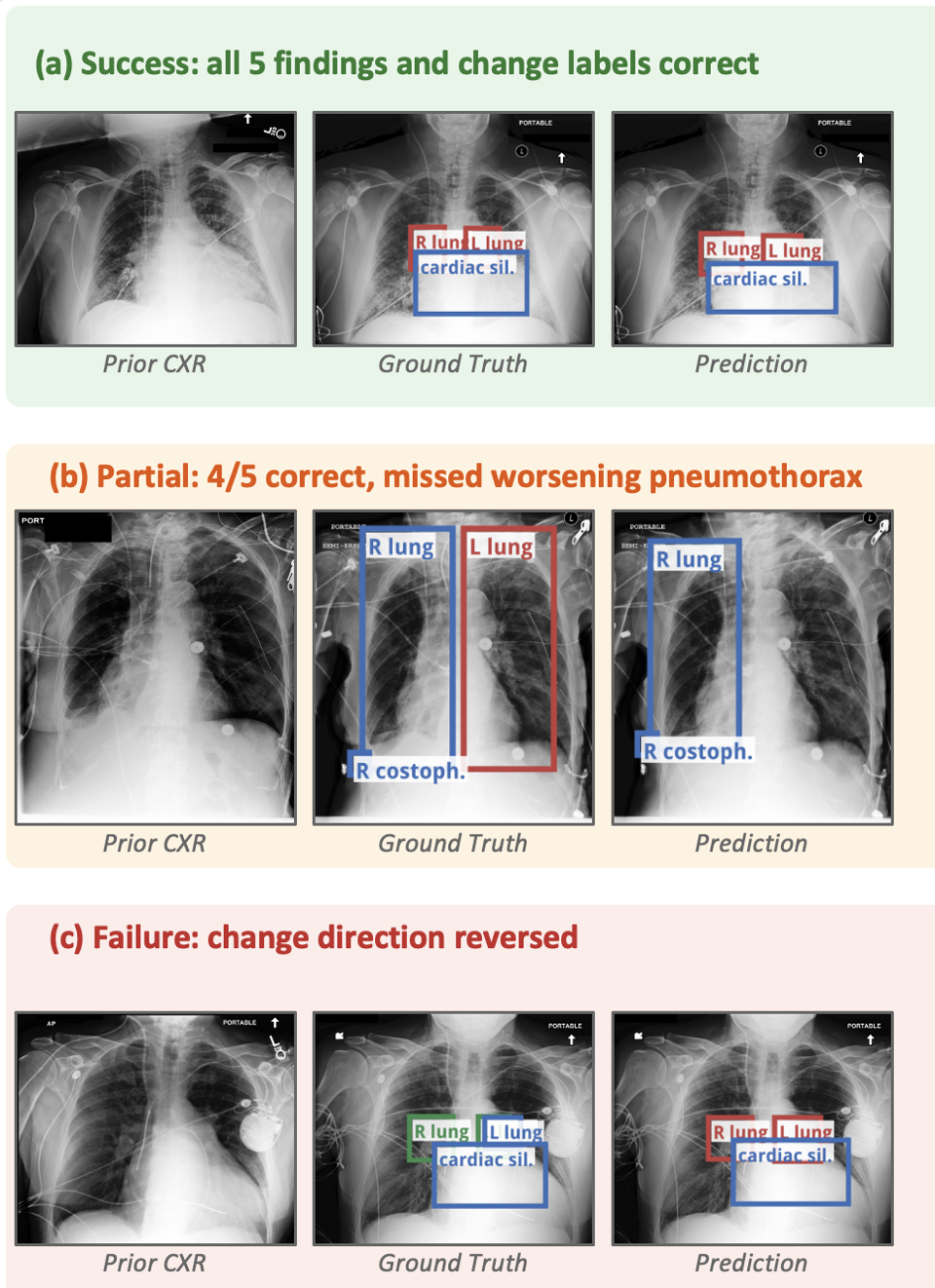 GRCD: Grounded Region Change Detection for Multi-Finding Chest X-Ray Pairs